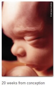 20-wks